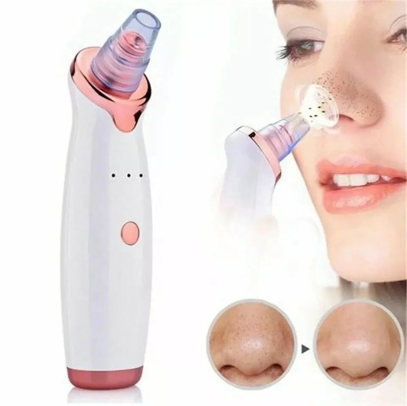Egonex Şarjlı Siyah Nokta Temizleme Cihazı 5 Başlıklı